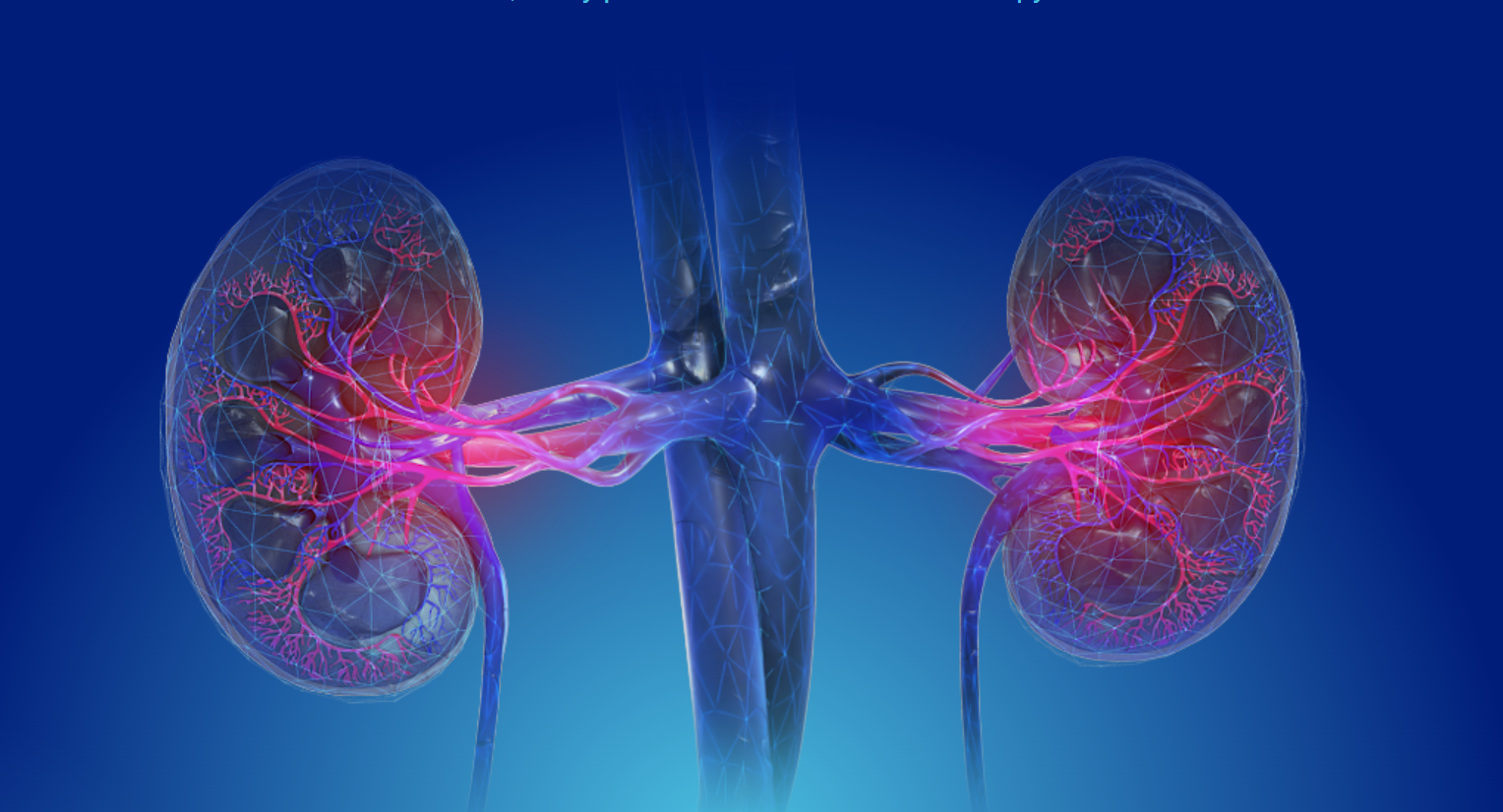 Mironid - Kidney